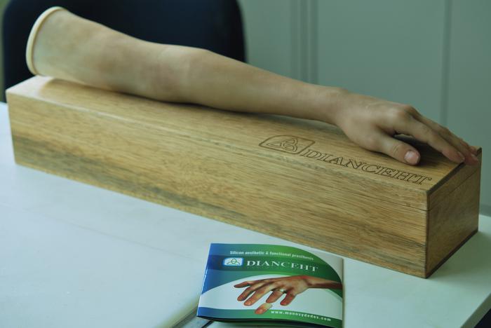 protesis para brazo, arm prosthesis